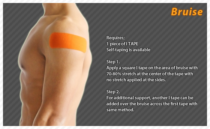 ares clinical taping - bruise