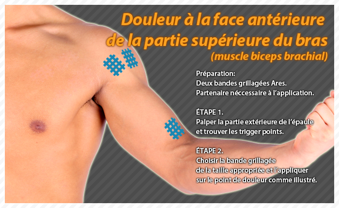 ares clinical taping - bruise