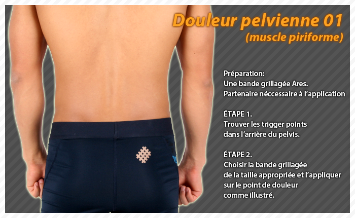 ares clinical taping - bruise
