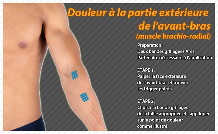 ares clinical taping - bruise