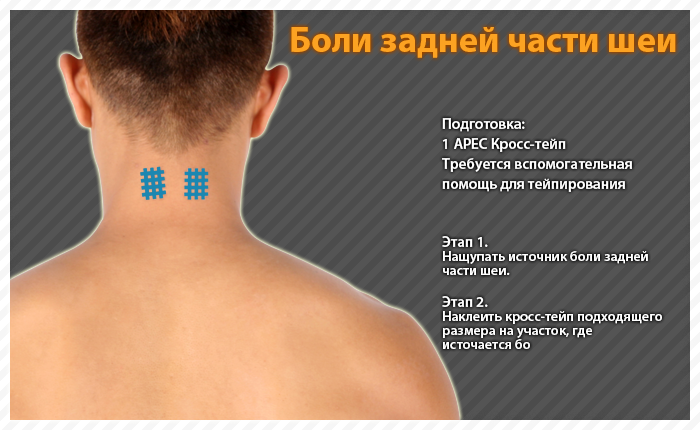 ares clinical taping - bruise